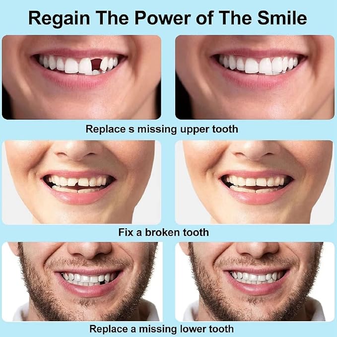 Last Day Of Discount 🔥 Moldable False Teeth